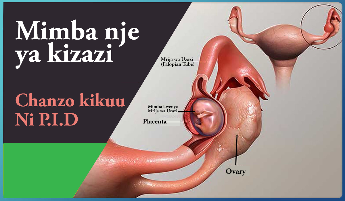 Ad slot